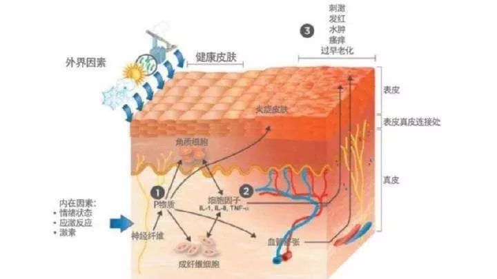 “屏障修復(fù)”修復(fù)的是什么？不同膚質(zhì)該如何搭配？